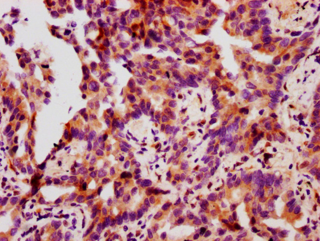 Phospho-HSP27 (Ser78) Antibody in Immunohistochemistry (Paraffin) (IHC (P))