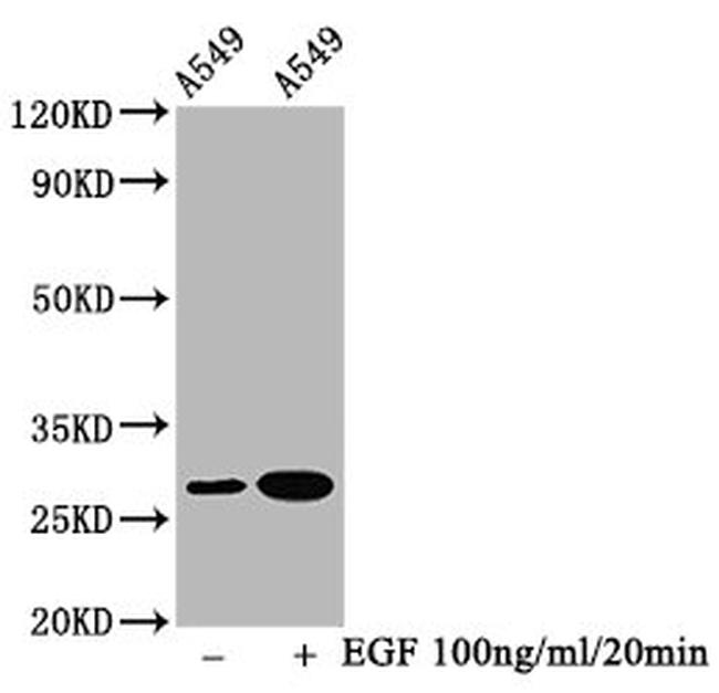 Phospho-HSP27 (Ser78) Antibody in Western Blot (WB)