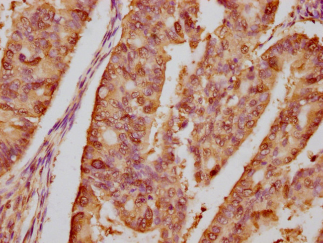 HSP90 alpha Antibody in Immunohistochemistry (Paraffin) (IHC (P))