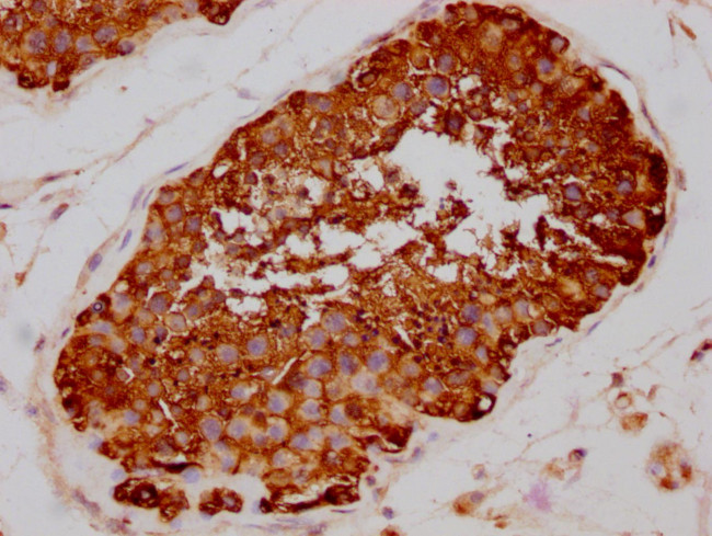 HSP90 alpha Antibody in Immunohistochemistry (Paraffin) (IHC (P))