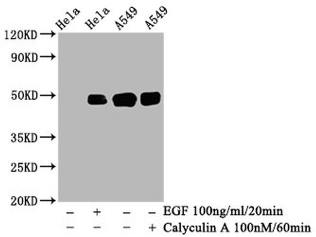 Phospho-c-Jun (Ser63) Antibody in Western Blot (WB)