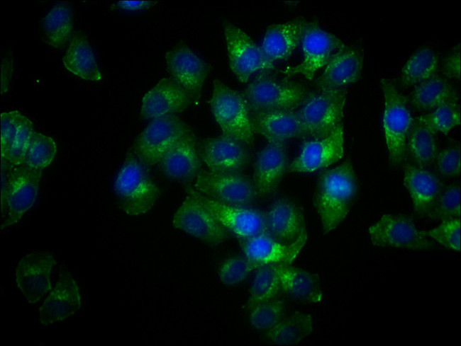 Phospho-LAT (Tyr191) Antibody in Immunocytochemistry (ICC/IF)