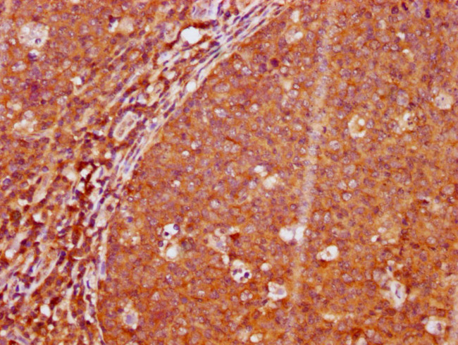 Phospho-LAT (Tyr191) Antibody in Immunohistochemistry (Paraffin) (IHC (P))