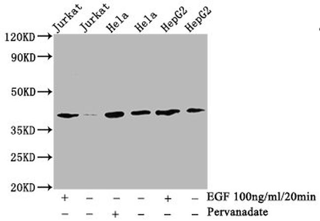 Phospho-LAT (Tyr191) Antibody in Western Blot (WB)