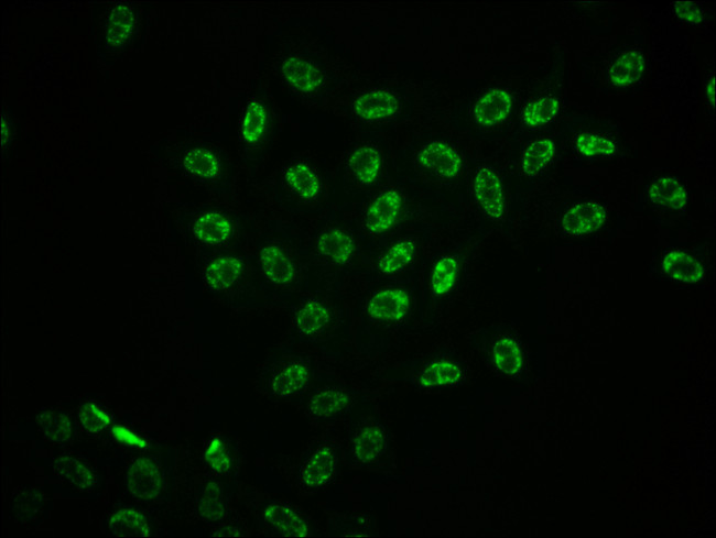 Phospho-ERK1/ERK2 (Thr185, Thr202) Antibody in Immunocytochemistry (ICC/IF)