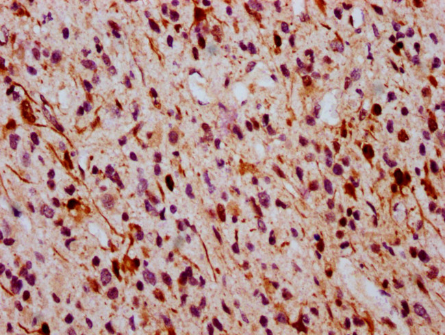 Phospho-ERK1/ERK2 (Thr185, Thr202) Antibody in Immunohistochemistry (Paraffin) (IHC (P))