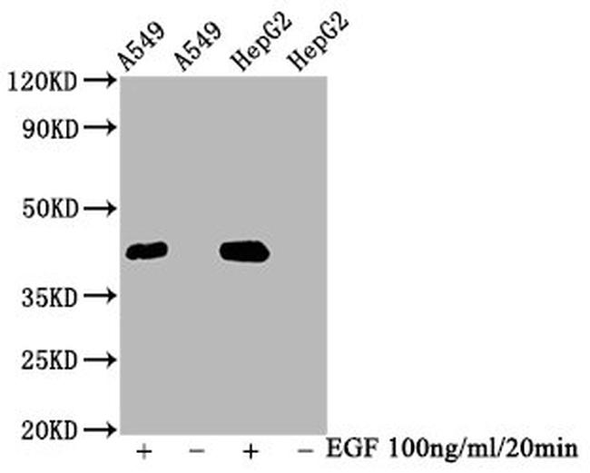 Phospho-ERK1/ERK2 (Thr185, Thr202) Antibody in Western Blot (WB)