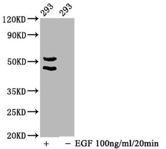 Phospho-JNK1/JNK2/JNK3 (Thr183, Thr221) Antibody in Western Blot (WB)