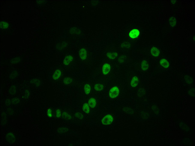 Phospho-c-Myc (Ser62) Antibody in Immunocytochemistry (ICC/IF)