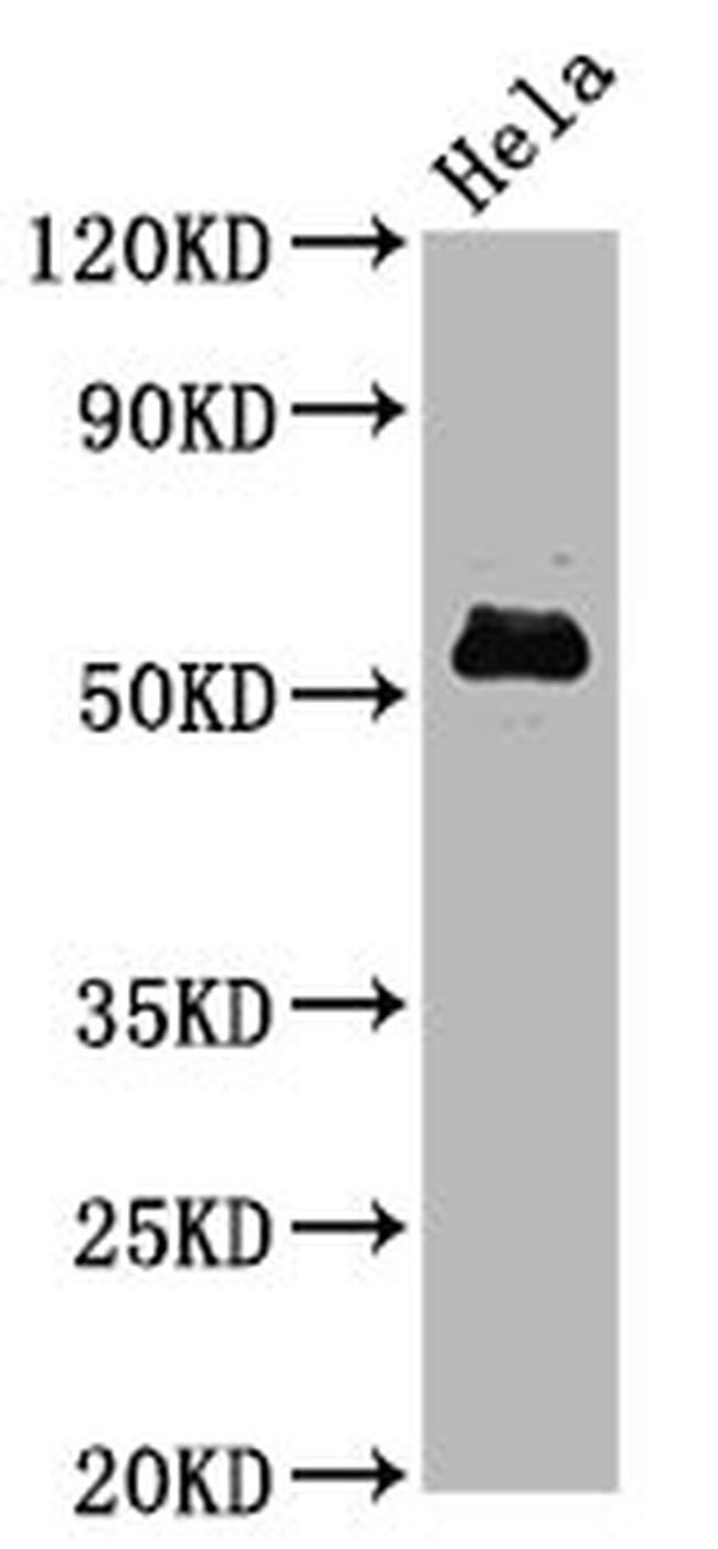 Phospho-c-Myc (Ser62) Antibody in Western Blot (WB)