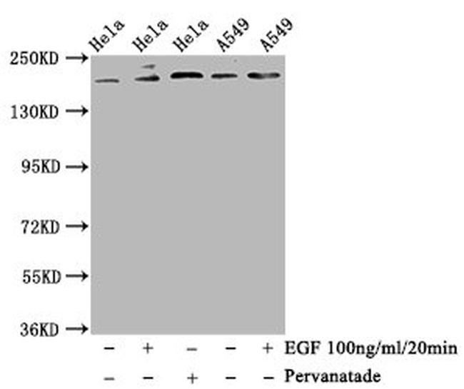 Phospho-PDGFRB (Tyr740) Antibody in Western Blot (WB)