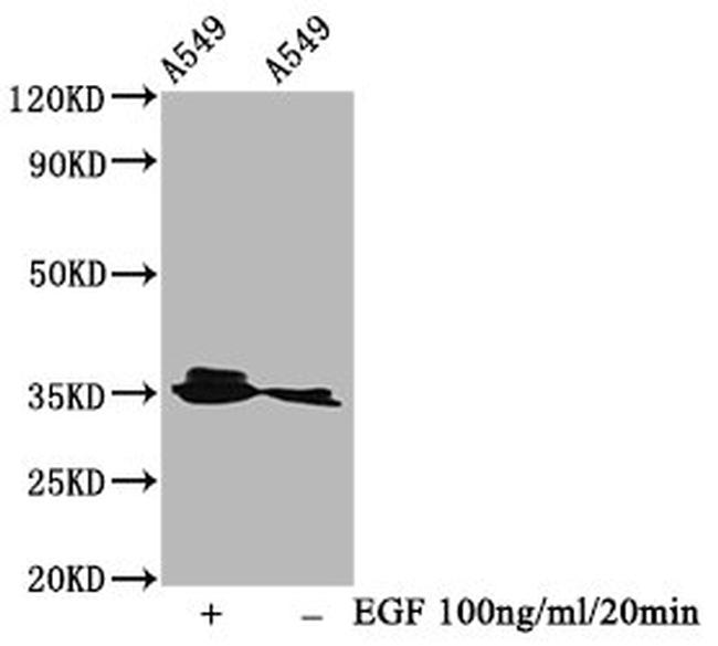 Phospho-PP2A alpha (Tyr307) Antibody in Western Blot (WB)