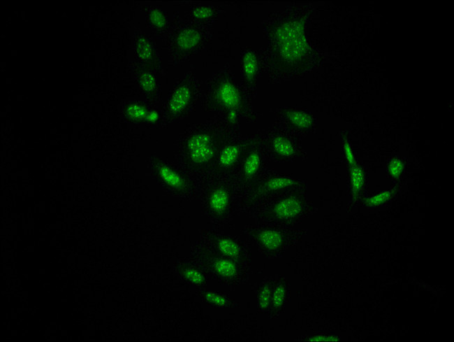 Phospho-c-Raf (Ser621) Antibody in Immunocytochemistry (ICC/IF)