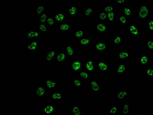 Phospho-p70 S6 Kinase (Thr421, Ser424) Antibody in Immunocytochemistry (ICC/IF)