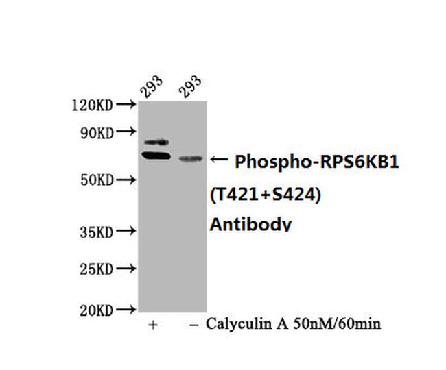 Phospho-p70 S6 Kinase (Thr421, Ser424) Antibody in Western Blot (WB)