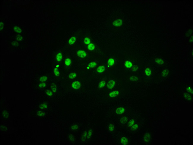 Phospho-STAT1 (Ser727) Antibody in Immunocytochemistry (ICC/IF)