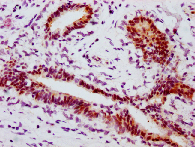 Phospho-STAT1 (Ser727) Antibody in Immunohistochemistry (Paraffin) (IHC (P))