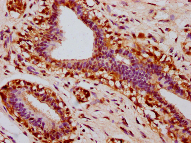 Phospho-STAT3 (Ser727) Antibody in Immunohistochemistry (Paraffin) (IHC (P))