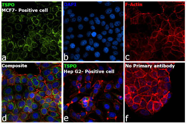 TSPO Antibody in Immunocytochemistry (ICC/IF)