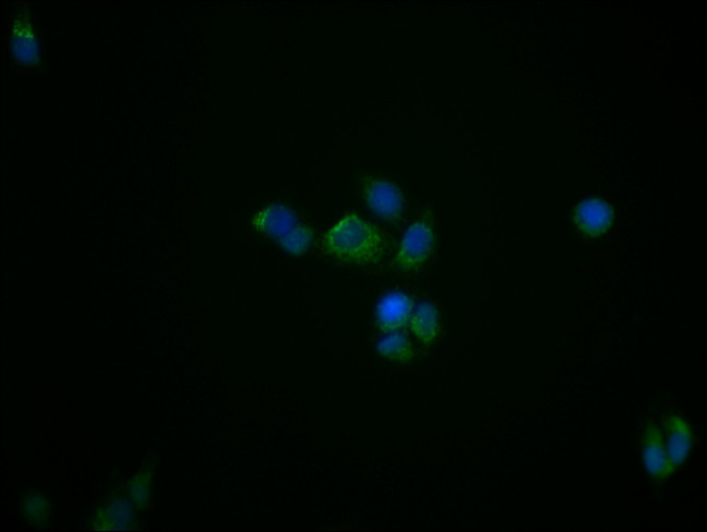 TSPO Antibody in Immunocytochemistry (ICC/IF)