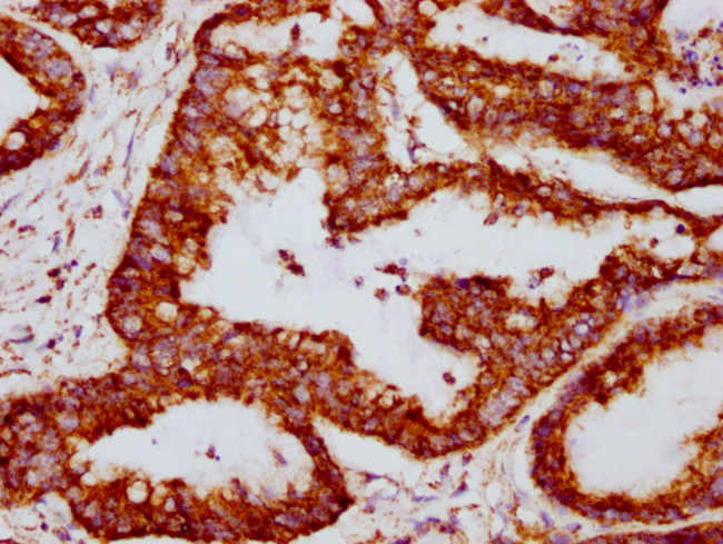 TSPO Antibody in Immunohistochemistry (Paraffin) (IHC (P))