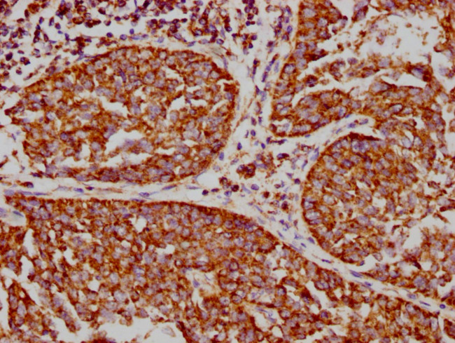 VDAC Antibody in Immunohistochemistry (Paraffin) (IHC (P))