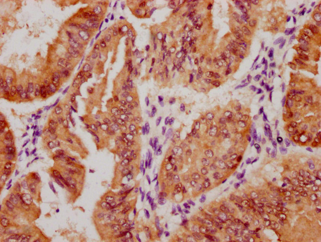 Phospho-YAP1 (Ser127) Antibody in Immunohistochemistry (Paraffin) (IHC (P))