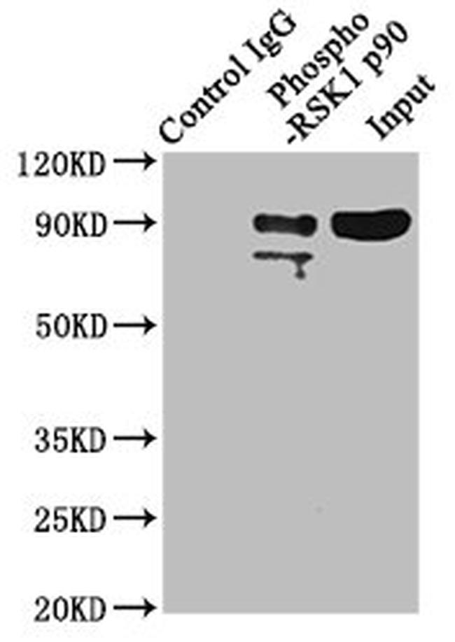Phospho-RSK1 (Thr359, Ser363) Antibody in Western Blot (WB)