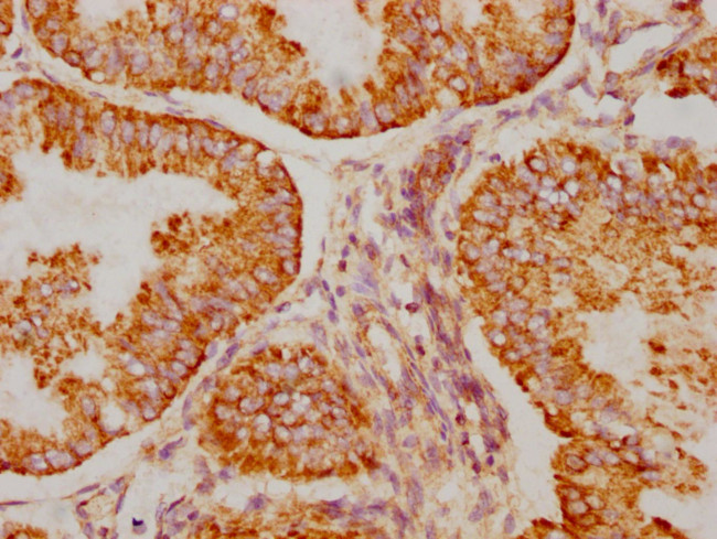 BAK Antibody in Immunohistochemistry (Paraffin) (IHC (P))