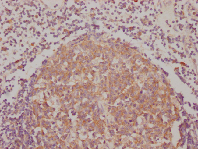 BAK Antibody in Immunohistochemistry (Paraffin) (IHC (P))