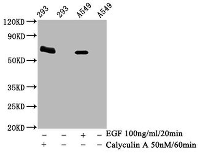 Phospho-AMPK alpha-2 (Thr172) Antibody in Western Blot (WB)