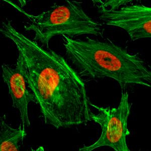 H3K4me2 Antibody in Immunocytochemistry (ICC/IF)