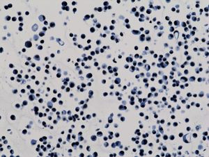 H3K9ac Antibody in Immunocytochemistry (ICC/IF)