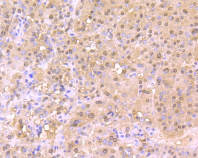 Cullin 4A Antibody in Immunohistochemistry (Paraffin) (IHC (P))