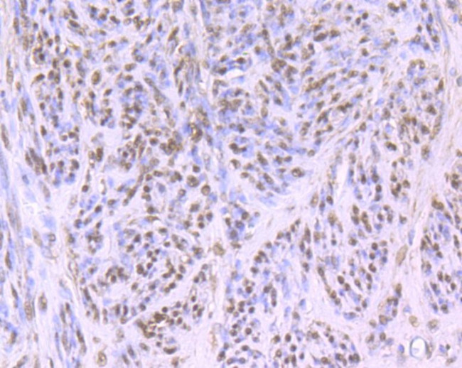 Cullin 4A Antibody in Immunohistochemistry (Paraffin) (IHC (P))