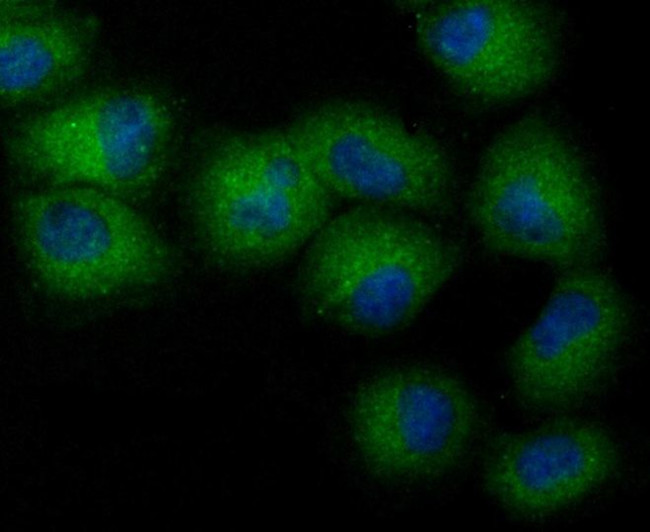 NCK1 Antibody in Immunocytochemistry (ICC/IF)