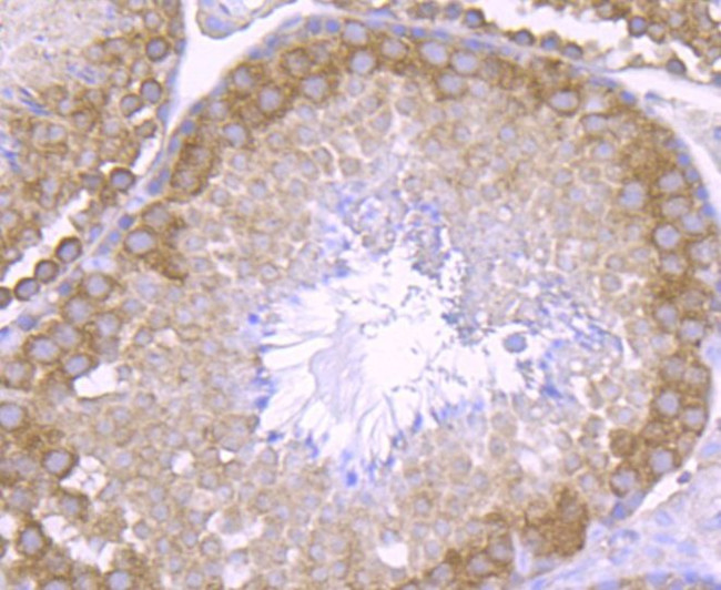 NCK1 Antibody in Immunohistochemistry (Paraffin) (IHC (P))