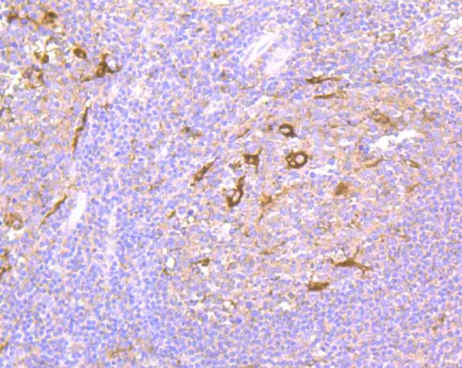 NCK1 Antibody in Immunohistochemistry (Paraffin) (IHC (P))