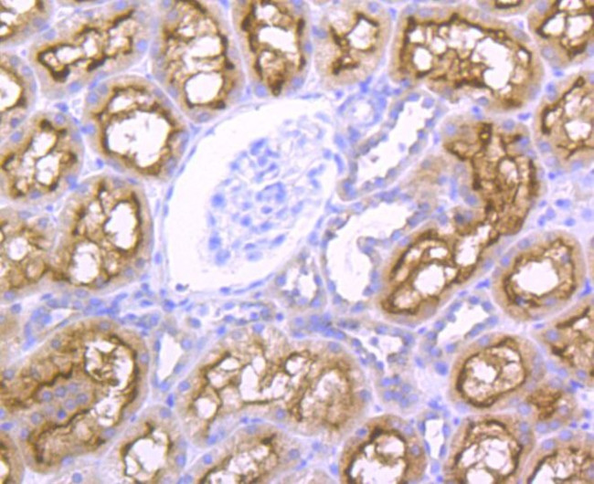 NCK1 Antibody in Immunohistochemistry (Paraffin) (IHC (P))