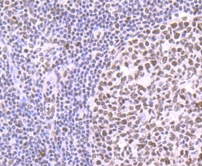 PTBP1 Antibody in Immunohistochemistry (Paraffin) (IHC (P))