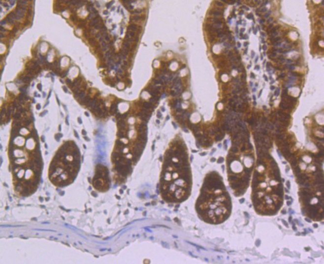 Villin Antibody in Immunohistochemistry (Paraffin) (IHC (P))