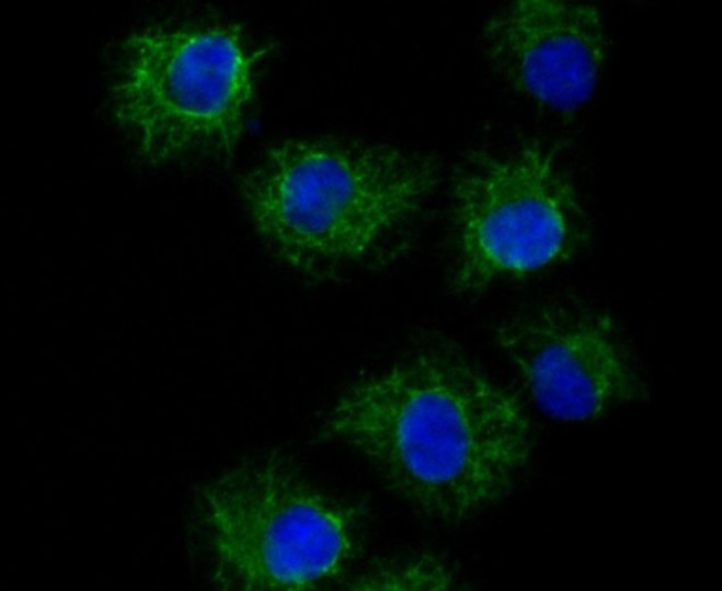 TYRP1 Antibody in Immunocytochemistry (ICC/IF)