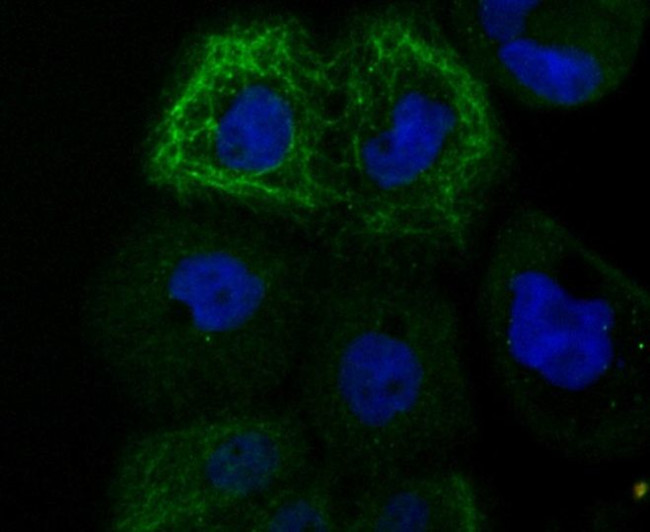 TYRP1 Antibody in Immunocytochemistry (ICC/IF)