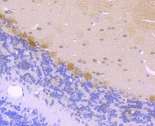 CK2 beta Antibody in Immunohistochemistry (Paraffin) (IHC (P))