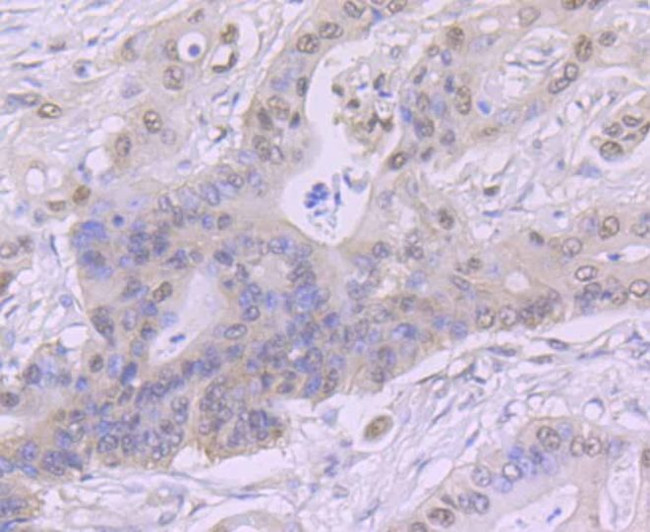 CK2 beta Antibody in Immunohistochemistry (Paraffin) (IHC (P))