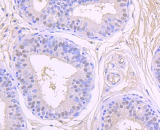 CK2 beta Antibody in Immunohistochemistry (Paraffin) (IHC (P))