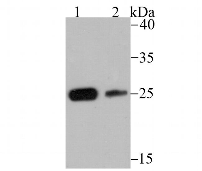 CK2 beta Antibody in Western Blot (WB)