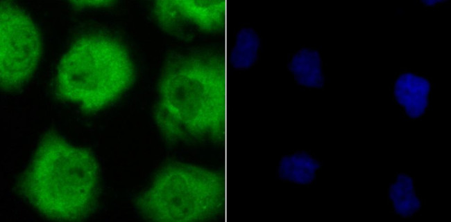 GLO1 Antibody in Immunocytochemistry (ICC/IF)