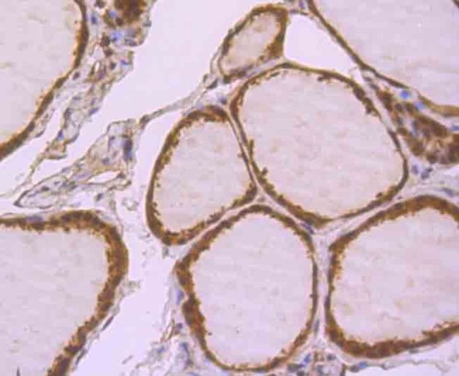 GLO1 Antibody in Immunohistochemistry (Paraffin) (IHC (P))