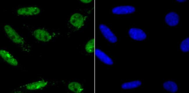 MAD2 Antibody in Immunocytochemistry (ICC/IF)